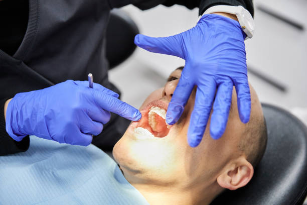 Best Emergency Tooth Extraction in Hasley Nyon, CA
